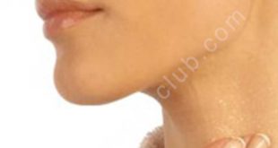 arrugas del cuello